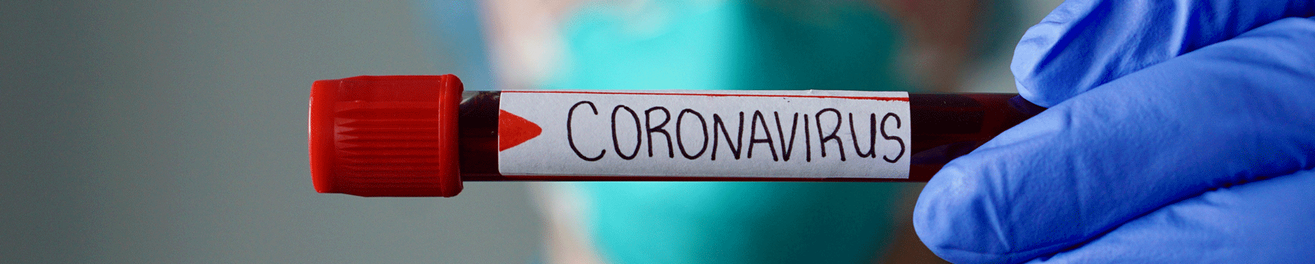 EAD—blackboard-informações-coronavirus