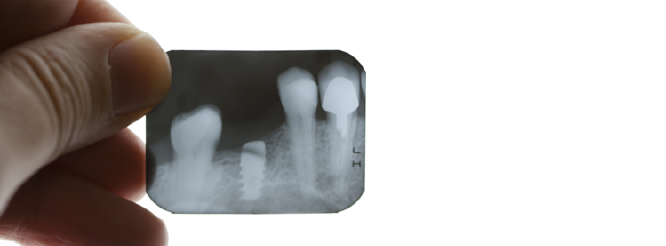 filmes-radiograficos